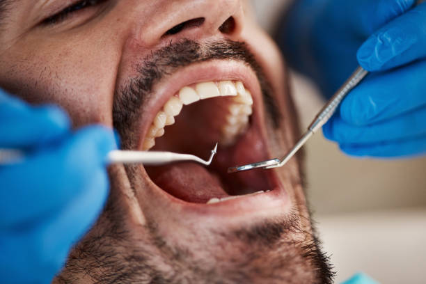 Best Dental Bonding  in Coosada, AL